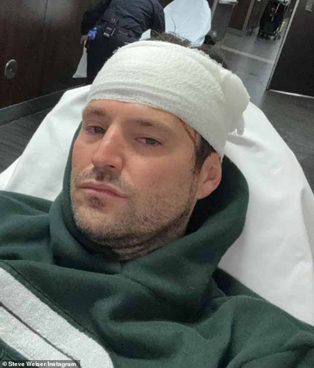 Марк Райт рассказал, что его срочно доставили в больницу в Лас-Вегасе после удара головой, и в итоге ему потребовалось наложить более 30 швов.
